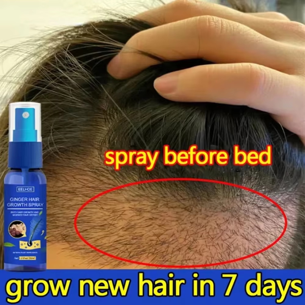 Fast Ginger Hair Growth Spray  - Growth Factor Serum recension och pris